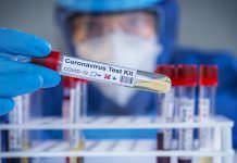 Der Coronatest in Ungarn