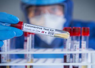 Der Coronatest in Ungarn