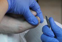 Wieder Sommer, wieder schöne Füße … – Újra nyár és újra látszanak a szépen ápolt lábak!